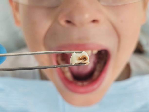 Best Weekend Emergency Dentist in Mauston, WI